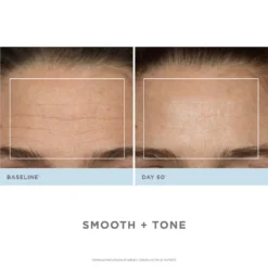 NuFACE Trinity Pro Facial Toning Kit + ELE