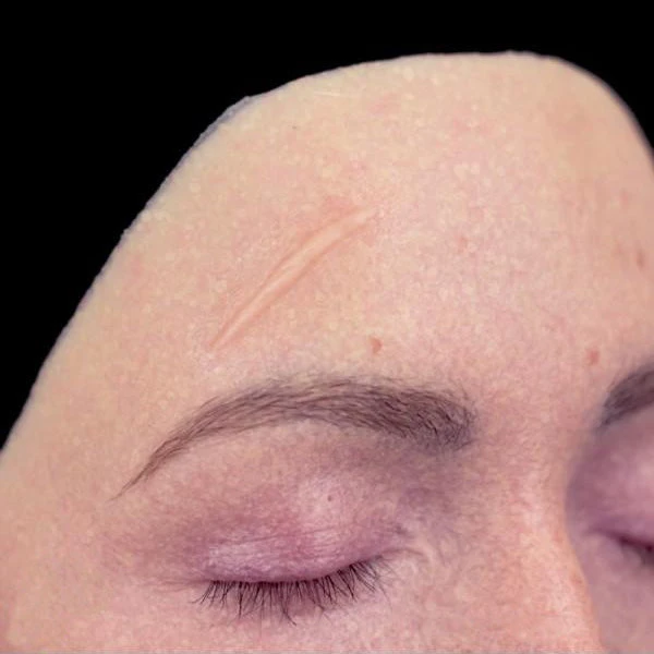 Out Of Kit Single Scar (Small) 2 Out Of Kit Single Scar (Small)