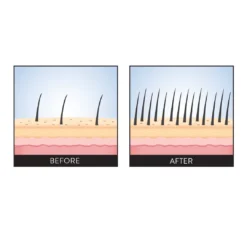 Philip B Scalp Booster 8 Philip B Scalp Booster