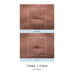 NuFACE NuBODY Toning And Firming Kit